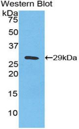 Western blot of recombinant NFKBIZ / IKBZ.