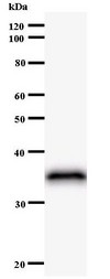 Western blot of immunized recombinant protein using NFRKB antibody.