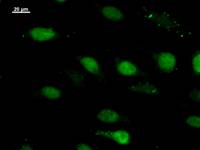 Immunostaining analysis in HeLa cells. HeLa cells were fixed with 4% paraformaldehyde and permeabilized with 0.1% Triton X-100 in PBS. The cells were immunostained with anti-NFRKB mAb.