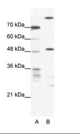A: Marker, B: HepG2 Cell Lysate