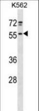 NFS1 Antibody western blot of K562 cell line lysates (35 ug/lane). The NFS1 antibody detected the NFS1 protein (arrow).