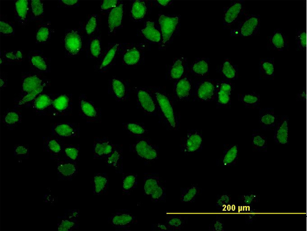 Immunofluorescence of monoclonal antibody to NFX1 on HeLa cell. [antibody concentration 30 ug/ml]