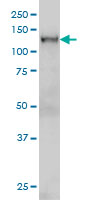 NFX1 monoclonal antibody (M01), clone 1D12 Western Blot analysis of NFX1 expression in HeLa NE.