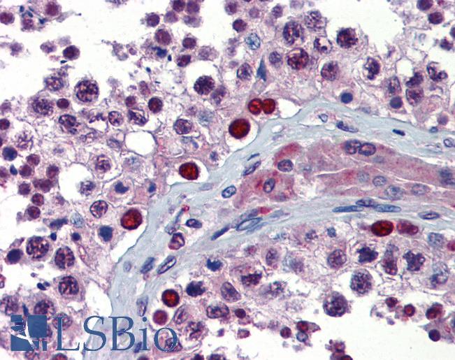 Anti-NFX1 antibody IHC of human testis. Immunohistochemistry of formalin-fixed, paraffin-embedded tissue after heat-induced antigen retrieval. Antibody LS-B3576 concentration 5 ug/ml.