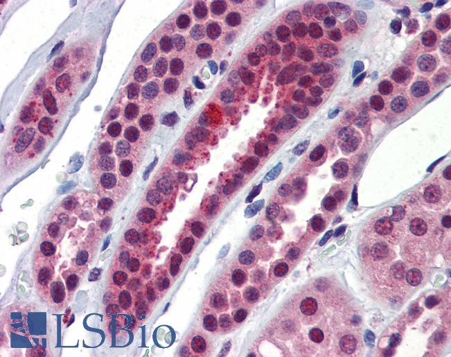 Anti-NFX1 antibody IHC of human kidney. Immunohistochemistry of formalin-fixed, paraffin-embedded tissue after heat-induced antigen retrieval. Antibody LS-B3576 concentration 5 ug/ml.