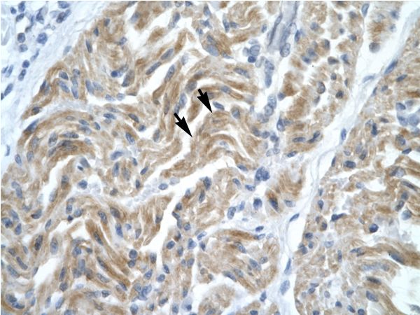 NFYA antibody LS-C29688 was used in IHC to stain formalin-fixed, paraffin-embedded human muscle.