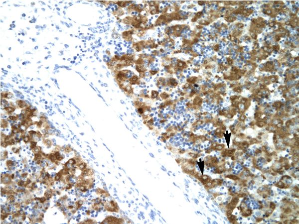 NFYA antibody LS-C29688 was used in IHC to stain formalin-fixed, paraffin-embedded human liver.