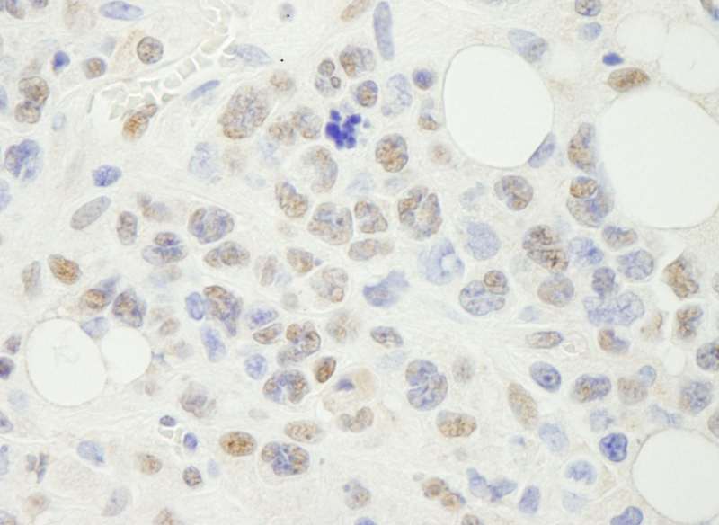 Detection of Mouse NF-YA by Immunohistochemistry. Sample: FFPE section of mouse hybridoma tumor. Antibody: Affinity purified rabbit anti-NF-YA used at a dilution of 1:250.