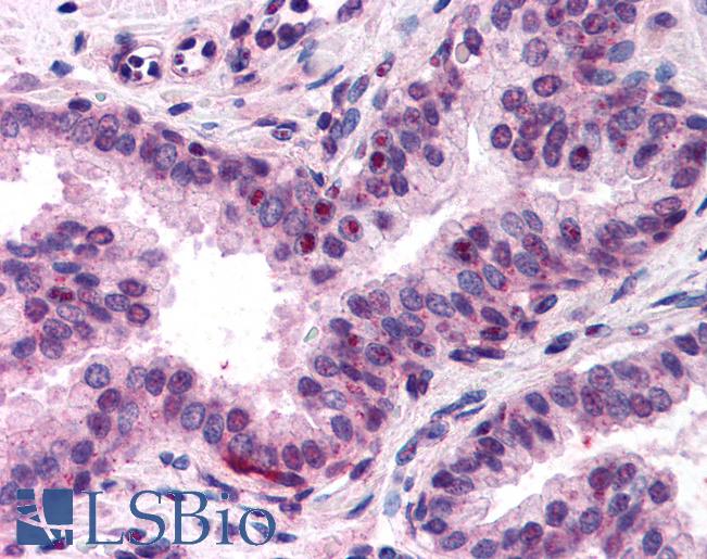 Anti-NFYA antibody IHC of human prostate. Immunohistochemistry of formalin-fixed, paraffin-embedded tissue after heat-induced antigen retrieval. Antibody LS-B131 dilution 1:400.