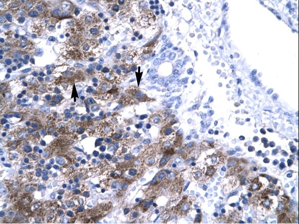 NFYA antibody LS-C31566 was used in IHC to stain formalin-fixed, paraffin-embedded human liver.