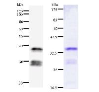 Left : Western blot analysis of immunized recombinant protein, using anti-NFYB monoclonal antibody. Right : CBB staining of immunized recombinant protein.