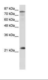 Transfected 293T Cell Lysate