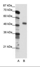 A: Marker, B: Jurkat Cell Lysate