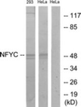 Western blot of extracts from HeLa/293 cells, using NFYC Antibody. The lane on the right is treated with the synthesized peptide.