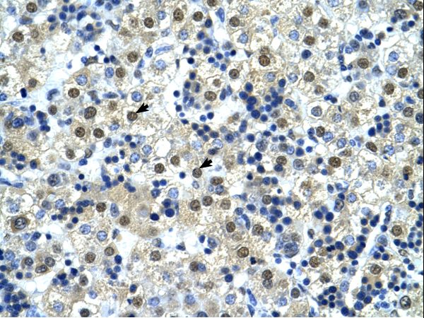 NFYC antibody LS-C80249 was used in IHC to stain formalin-fixed, paraffin-embedded human liver.