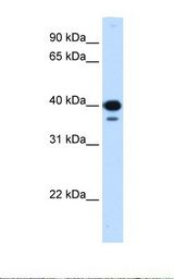 Transfected 293T cell lysate. Antibody concentration: 0.25 ug/ml. Gel concentration: 12%.