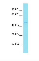 Western blot of Human Liver Tumor. NFYC antibody dilution 1.0 ug/ml.