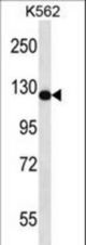 RASAL2 Antibody western blot of K562 cell line lysates (35 ug/lane). The RASAL2 antibody detected the RASAL2 protein (arrow).