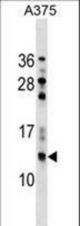 NGFRAP1 Antibody western blot of A375 cell line lysates (35 ug/lane). The NGFRAP1 antibody detected the NGFRAP1 protein (arrow).