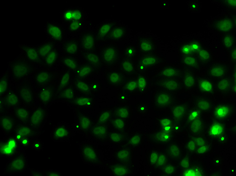Immunofluorescence blot of MCF7 cell using NGFRAP1 antibody.
