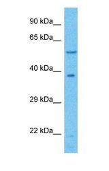 Western blot of NGLY1 Antibody with human 786-0 Whole Cell lysate.