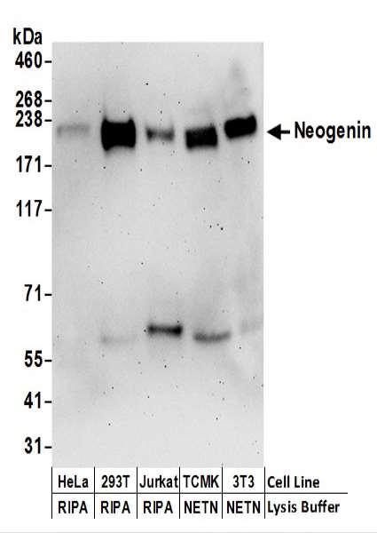 Detection of Human and Mouse Neogenin by Western Blot. Samples: Whole cell lysate (50 ug) prepared using NETN or RIPA buffer from HeLa, 293T, Jurkat, mouse TCMK-1, and mouse NIH3T3 cells. Antibodies: Affinity purified rabbit anti-Neogenin antibody used for WB at 0.1 ug/ml. Detection: Chemiluminescence with an exposure time of 3 minutes.