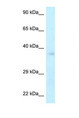NHEJ1 antibody LS-C145654 Western blot of ACHN Cell lysate. Antibody concentration 1 ug/ml.