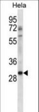 NHEJ1 Antibody western blot of HeLa cell line lysates (35 ug/lane). The NHEJ1 antibody detected the NHEJ1 protein (arrow).
