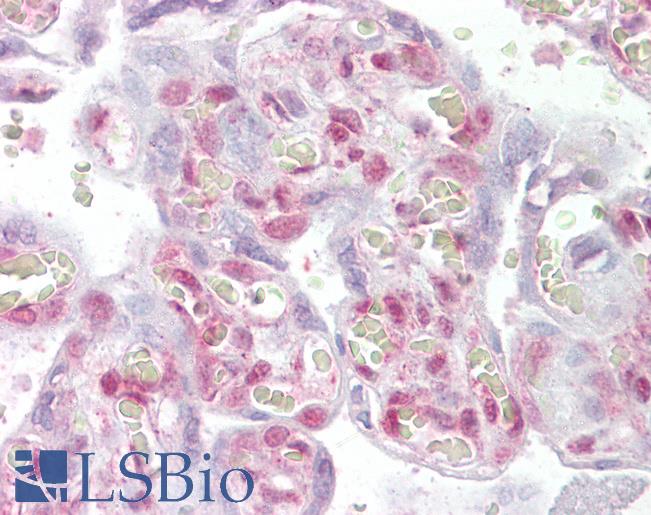 Anti-NHEJ1 antibody IHC of human placenta. Immunohistochemistry of formalin-fixed, paraffin-embedded tissue after heat-induced antigen retrieval. Antibody LS-B6468 concentration 2.5 ug/ml.