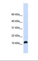 Fetal brain lysate. Antibody concentration: 1.0 ug/ml. Gel concentration: 10-20%.