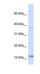 NHLH1 antibody LS-C82057 Western blot of Fetal Heart lysate.