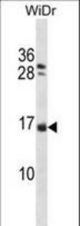 NHLH1 Antibody western blot of WiDr cell line lysates (35 ug/lane). The NHLH1 antibody detected the NHLH1 protein (arrow).