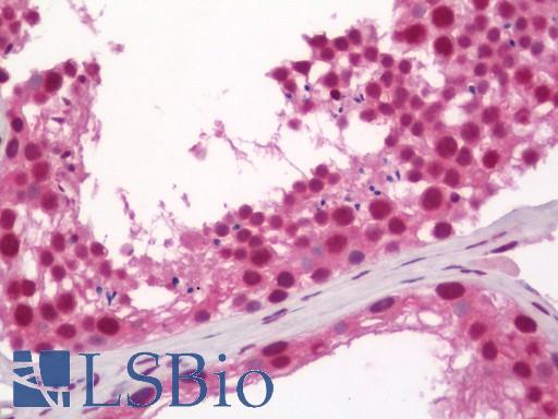 Human Testis: Formalin-Fixed, Paraffin-Embedded (FFPE)