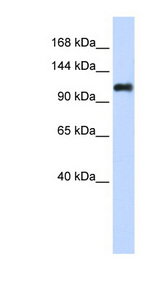 NID2 antibody LS-C111187 Western blot of Transfected 293T cell lysate.