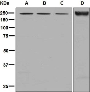 Western blot analysis on (A) fetal kidney, (B) BxPC-3, (C) fetal heart, and (D) fetal lung lysates using anti-NID2 antibody.