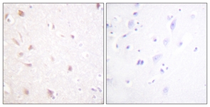 IHC of paraffin-embedded human brain tissue, using NIFK (Ab-234) Antibody. The picture on the right is treated with the synthesized peptide.
