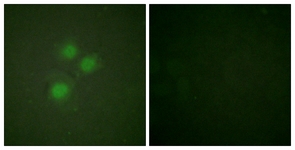 Immunofluorescence of HUVEC cells, using NIFK (Ab-234) Antibody. The picture on the right is treated with the synthesized peptide.