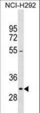 MKI67IP Antibody western blot of NCI-H292 cell line lysates (35 ug/lane). The MKI67IP antibody detected the MKI67IP protein (arrow).