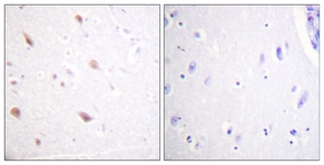 IHC of paraffin-embedded human brain, using NIFK (Phospho-Thr234) Antibody. The sample on the right was incubated with synthetic peptide.