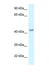 MECR antibody LS-C145477 Western blot of Fetal Brain lysate. Antibody concentration 1 ug/ml.