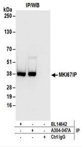 Detection of Human MKI67IP by Western Blot of Immunoprecipitates. Samples: Whole cell lysate (1 mg for IP; 20% of IP loaded) from 293T cells. Antibodies: Affinity purified rabbit anti-MKI67IP antibody used for IP at 6 ug/mg lysate. MKI67IP was also immunoprecipitated by rabbit anti-MKI67IP antibody BL14642. For blotting immunoprecipitated MKI67IP, was used at 0.2 ug/ml. Detection: Chemiluminescence with an exposure time of 3 seconds.