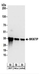Detection of Human MKI67IP by Western Blot. Samples: Whole cell lysate (50 ug) from 293T, HeLa, and Jurkat cells. Antibodies: Affinity purified rabbit anti-MKI67IP antibody used for WB at 0.04 ug/ml. Detection: Chemiluminescence with an exposure time of 10 seconds.