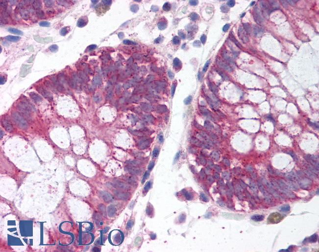 Anti-MKI67IP antibody IHC of human colon. Immunohistochemistry of formalin-fixed, paraffin-embedded tissue after heat-induced antigen retrieval. Antibody LS-B1546 concentration 5 ug/ml.