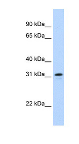 MKI67IP antibody LS-B1546 Western blot of Fetal Thymus lysate.