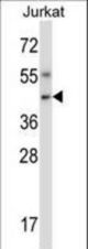 Mouse Nim1 Antibody western blot of Jurkat cell line lysates (35 ug/lane). The Nim1 antibody detected the Nim1 protein (arrow).