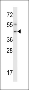 Mouse Nim1 Antibody western blot of mouse liver tissue lysates (35 ug/lane). The Nim1 antibody detected the Nim1 protein (arrow).