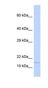 NINJ1 / Ninjurin antibody LS-C102226 Western blot of Fetal Lung lysate.