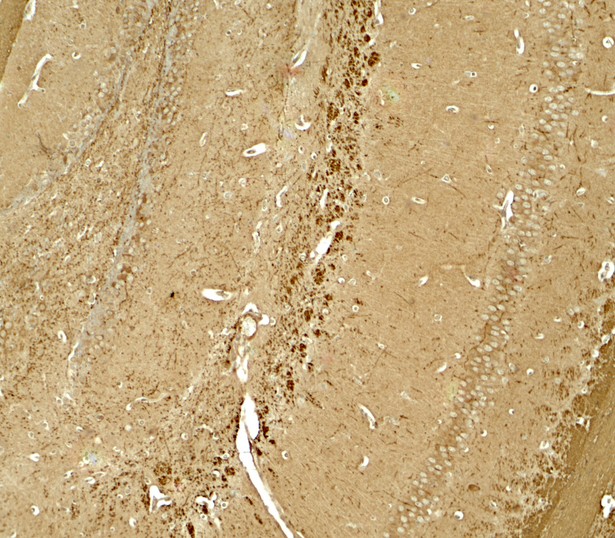 Immunohistochemistry of NINJ1 in mouse brain tissue with NINJ1 antibody at 5 ug/ml.