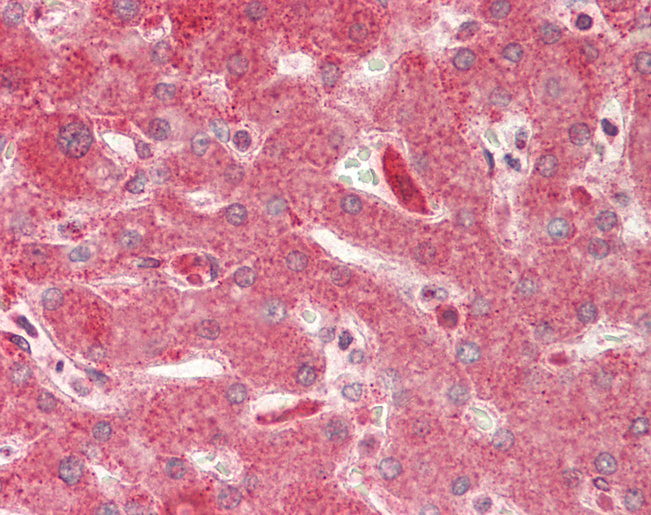 Human Liver: Formalin-Fixed, Paraffin-Embedded (FFPE)