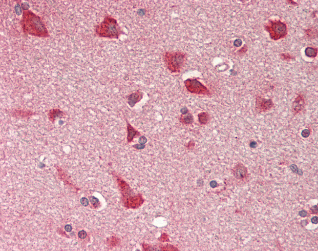 Human Brain, Cortex: Formalin-Fixed, Paraffin-Embedded (FFPE)